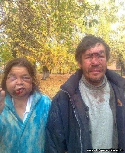 По парку гуляют бомжи